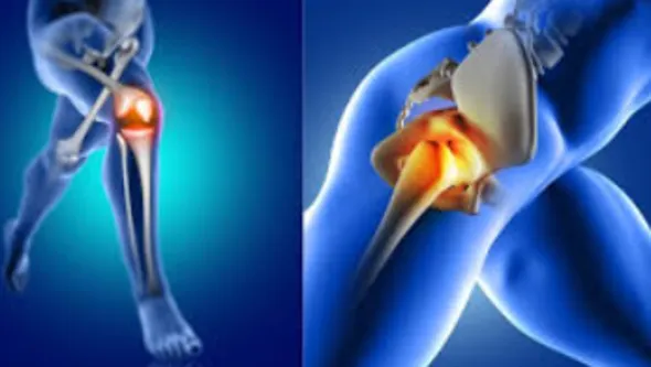 Advanced Knee and Hip Replacement at Anand Orthopa...