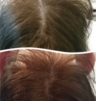 Hair Rejuvenation Treatment: Aesthetic Excellence ...
