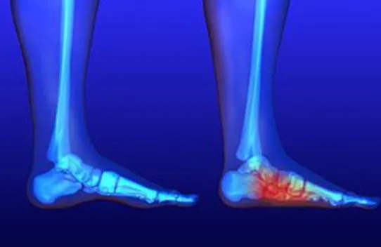 Specialized Deformity Correction at Anand Orthopae...