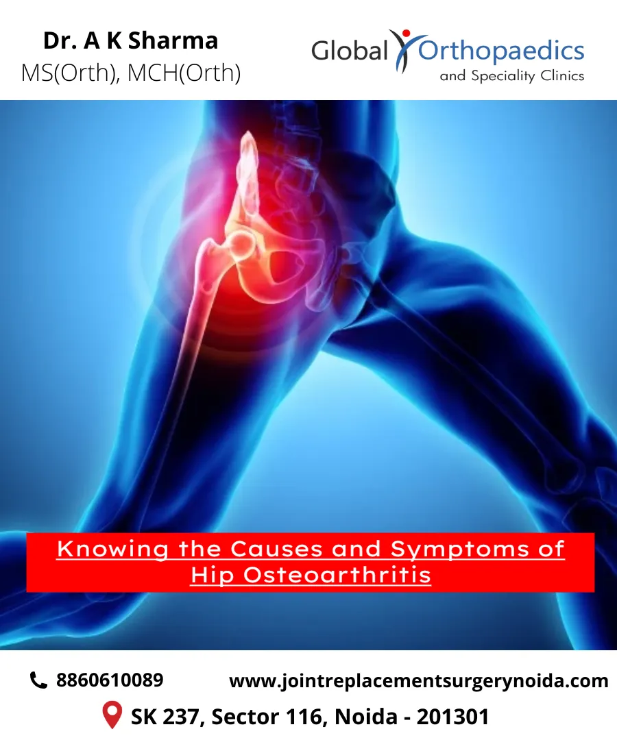 Knowing the Causes and Symptoms of Hip Osteoarthri...