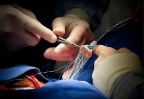 Valve Surgery Expertise at Dr K G Deshpande Memori...