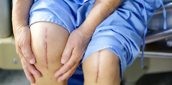 Optimal Orthopedic Care in Nashik: Dr. Rakesh Gosa...