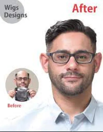 Revamp Your Look with Cutting-Edge Hair Solutions ...