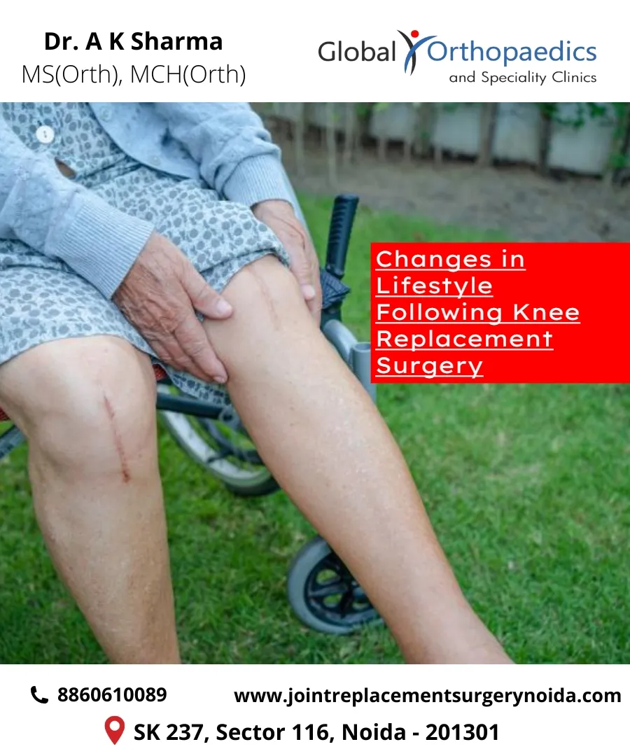 Knee replacement surgery in Noida
A crippling kne...