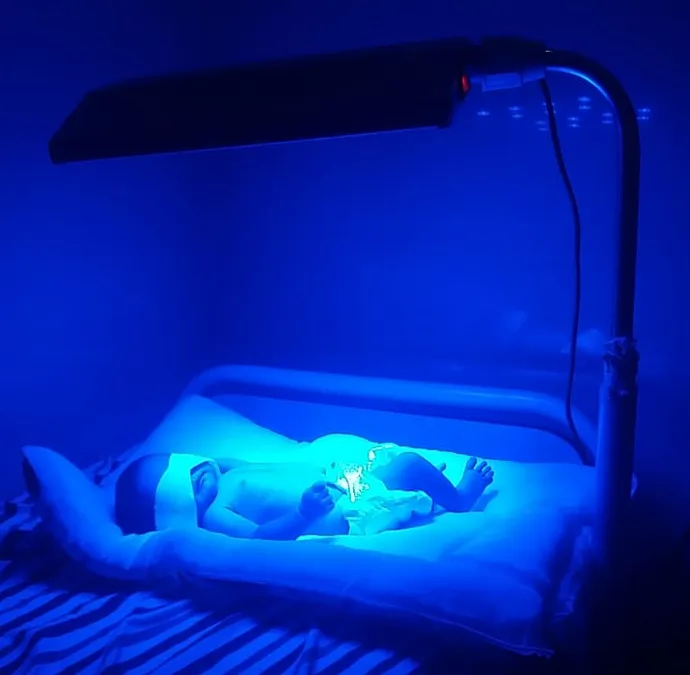 Physiological jaundice occurs in newborn when ther...