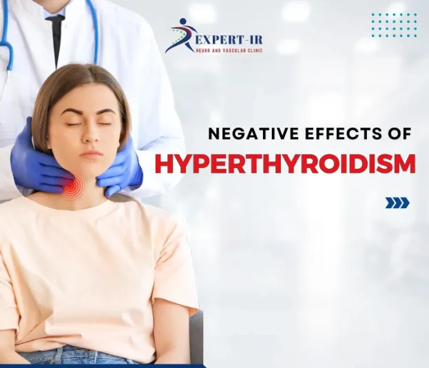 Hyperthyroidism takes a heavy toll on your body, a...