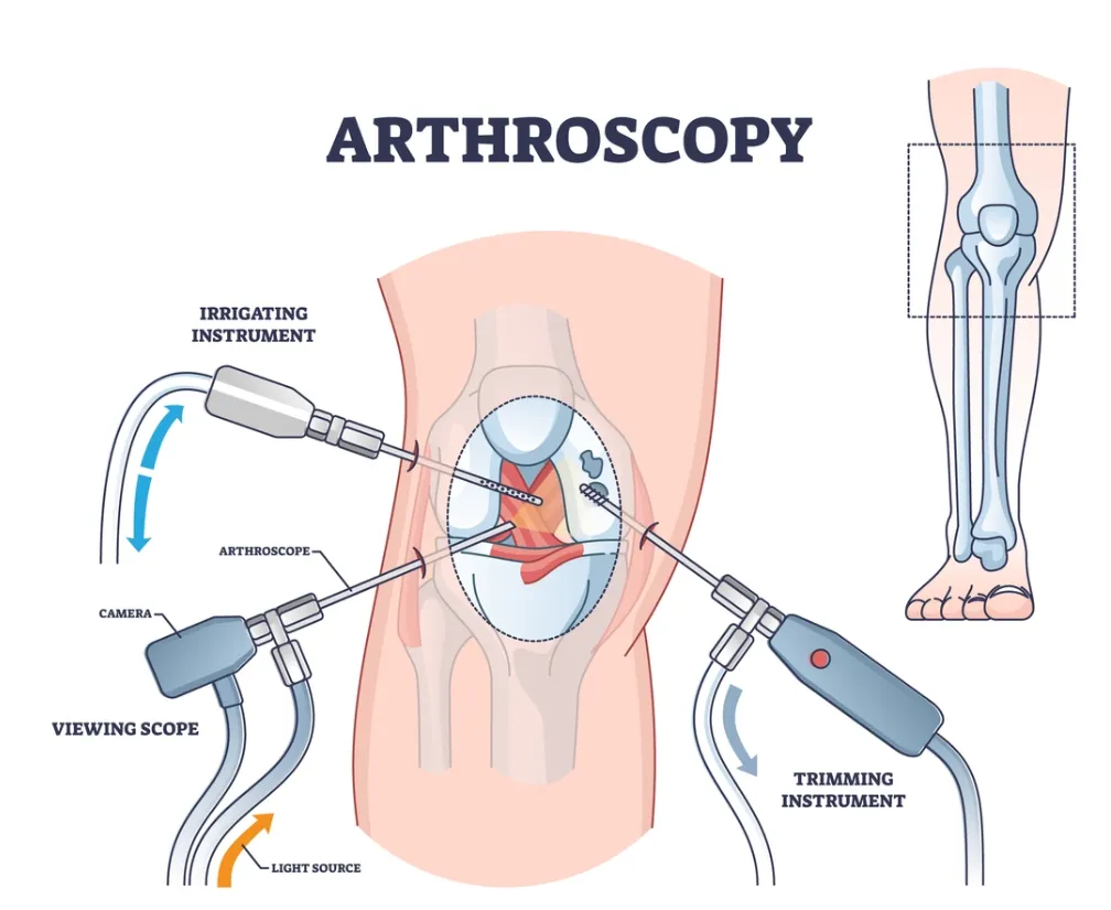 Arthroscopy Specialist Dr. Rakesh Gosavi in Nashik...