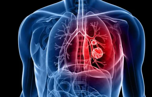 Comprehensive Thoracic Surgery at Dr K G Deshpande...