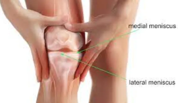 Comprehensive Care for Lateral Meniscus Tears by D...