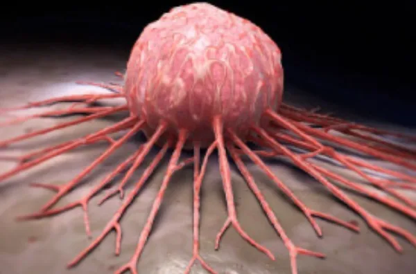 Leading the Fight Against Pediatric Solid Tumors: ...