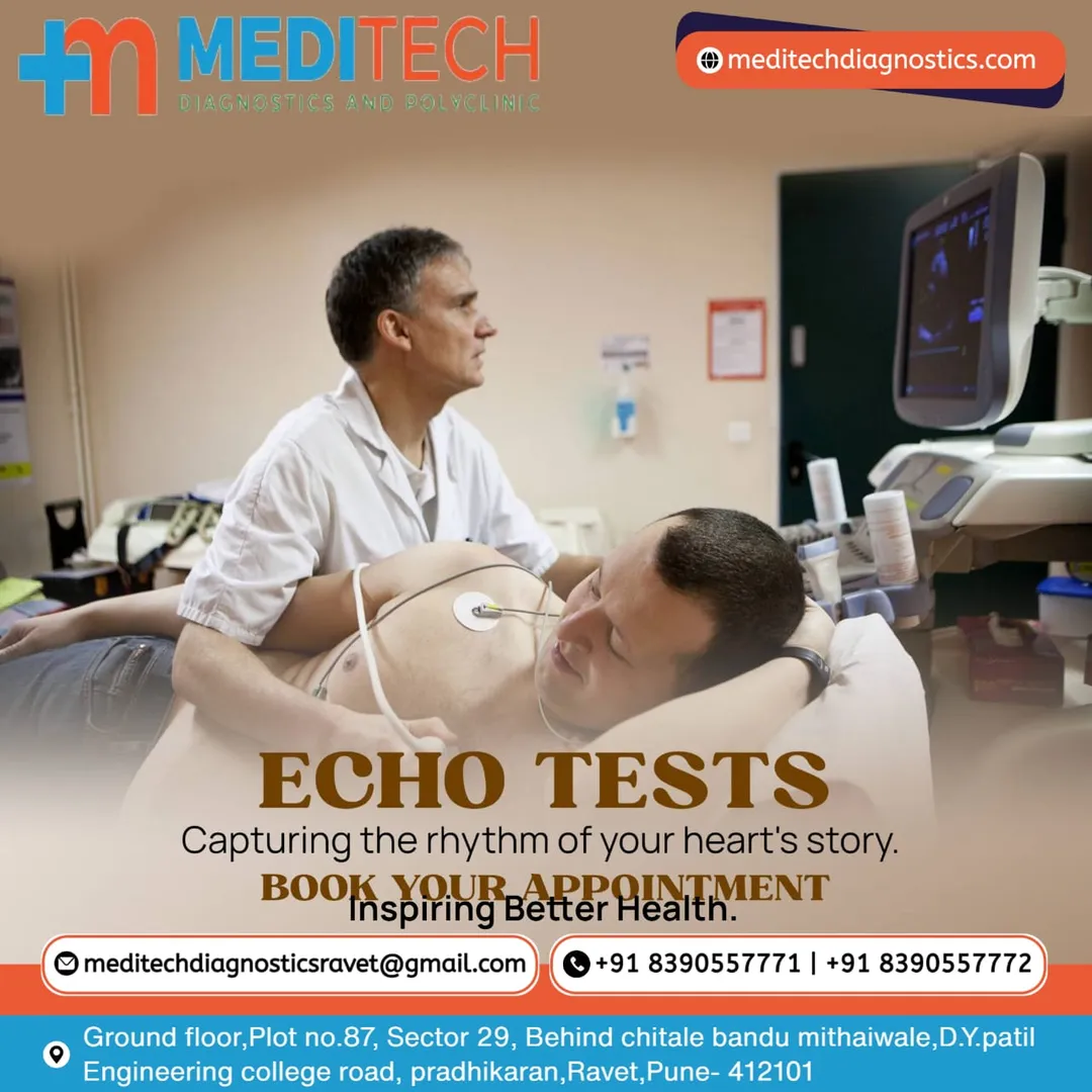 2D echocardiography, popularly called 2D echo, is ...
