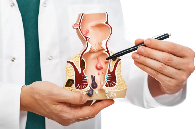 Revolutionizing Piles Treatment: Injection Therapy...
