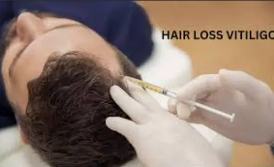 Revitalize Your Skin with Hair Transplant for Viti...