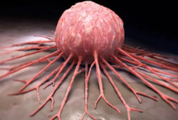 Advancements in Paediatric Solid Tumors: Insights ...
