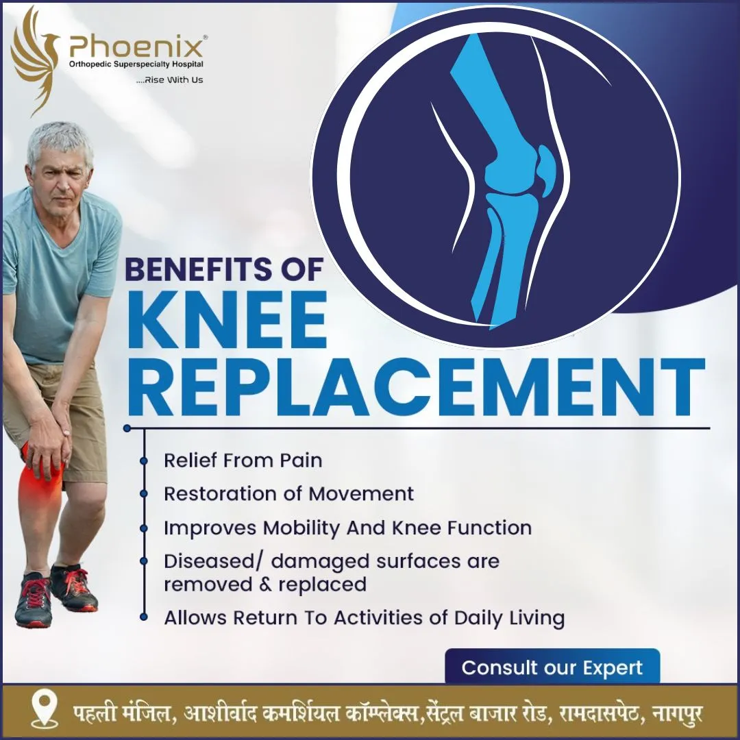 BEST ORTHOPEDICS HOSIPITAL IN NAGPUR. CONSULTANTS ...