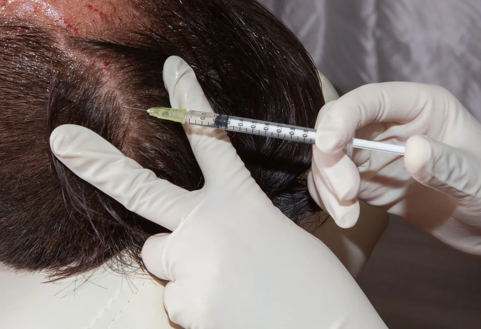 Hair Growth Treatment in West Delhi
Harness the r...