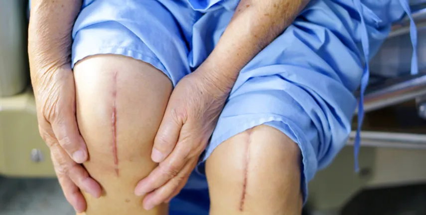 Best Doctor for Knee Replacement in Nashik: Dr. Ra...