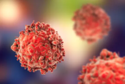 Expert Care for Leukemia and Lymphoma in Nagpur Be...
