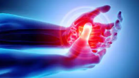 ARTHRITIS Managing Arthritis Pain with Expert Care...