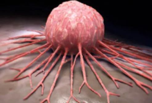 Paediatric Solid Tumors: Excellence in Care at Dr....