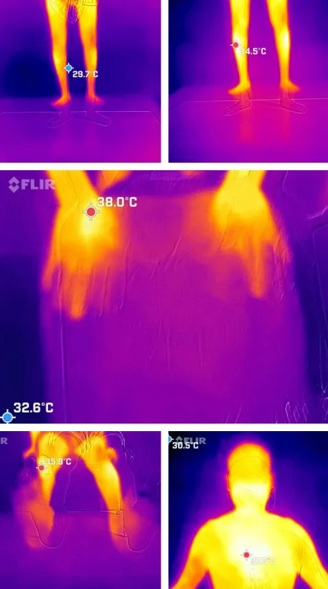 Thermography Services at Gindodia Hospital: Cuttin...