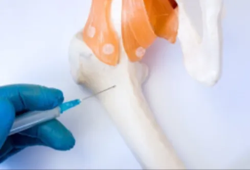 Bone Marrow Transplant (BMT) Expertise by Dr. Atis...