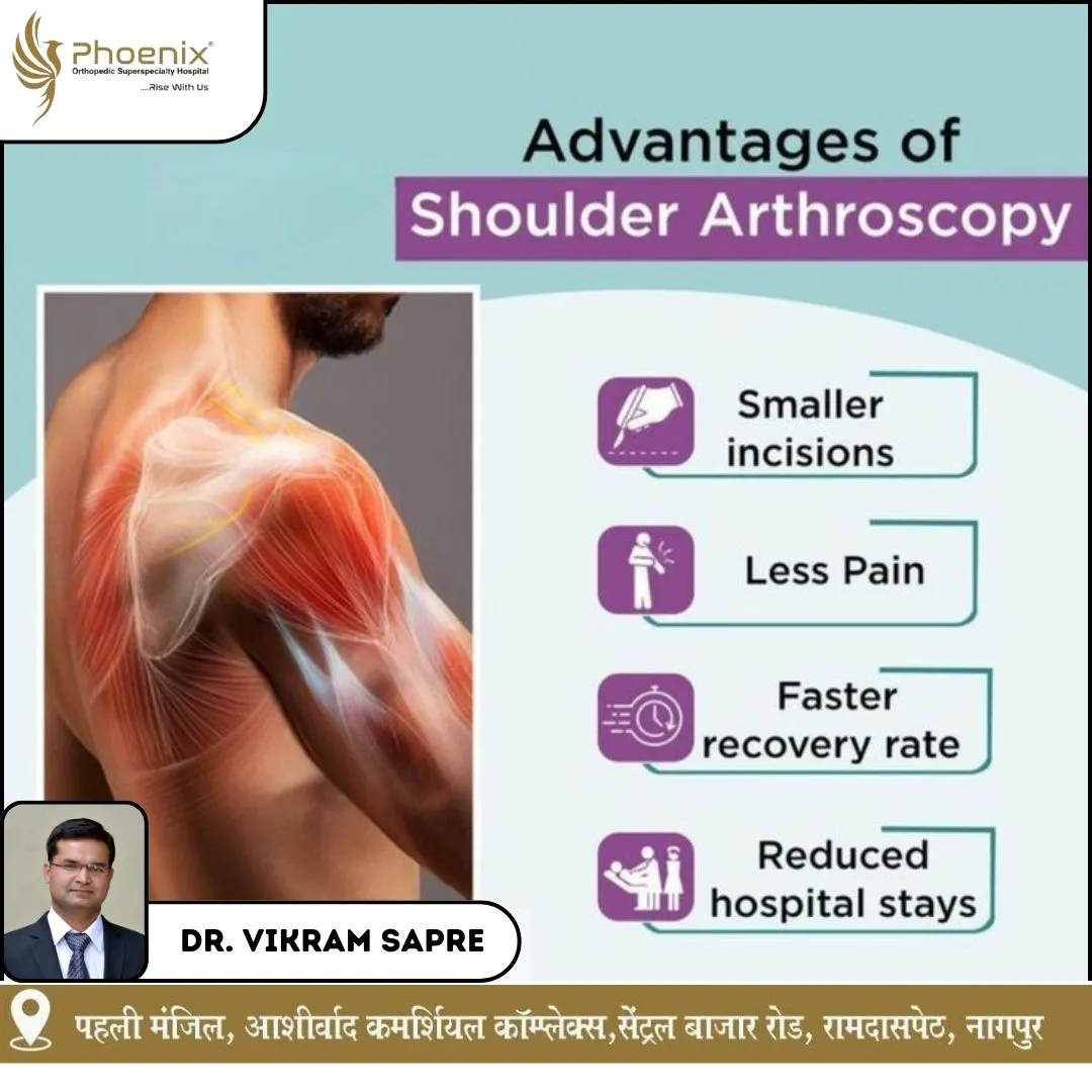 BEST ORTHOPEDICS HOSPITAL IN NAGPUR. CONSULTANTS A...