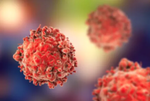 Leukemia and Lymphoma Expertise near me Dr. Atish ...