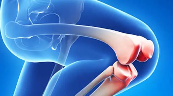 The Benefits of Total Knee Replacement Surger...