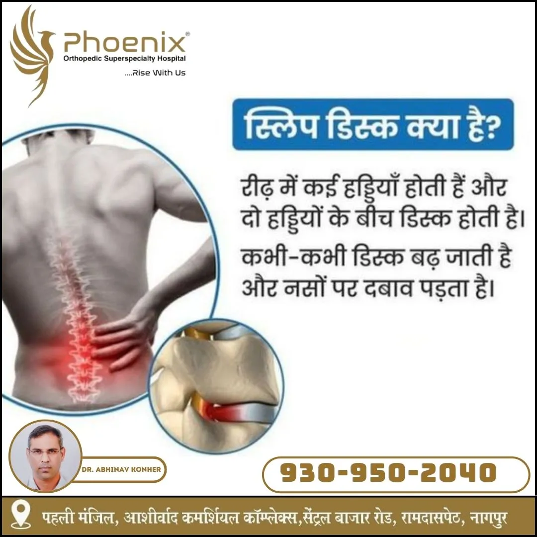 BEST ORTHOPEDICS HOSPITAL IN NAGPUR. CONSULTANTS A...