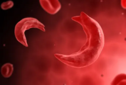 Hemoglobinopathy Insights near me Expert Hemoglobi...