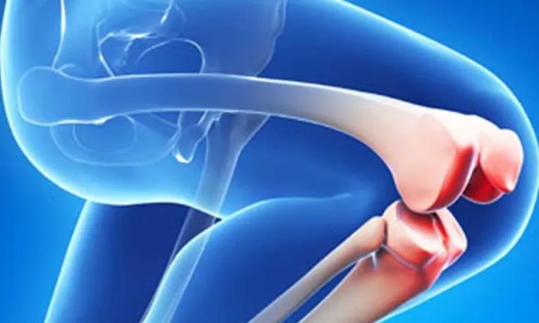 Comprehensive Care for Total Knee Replacement Tota...