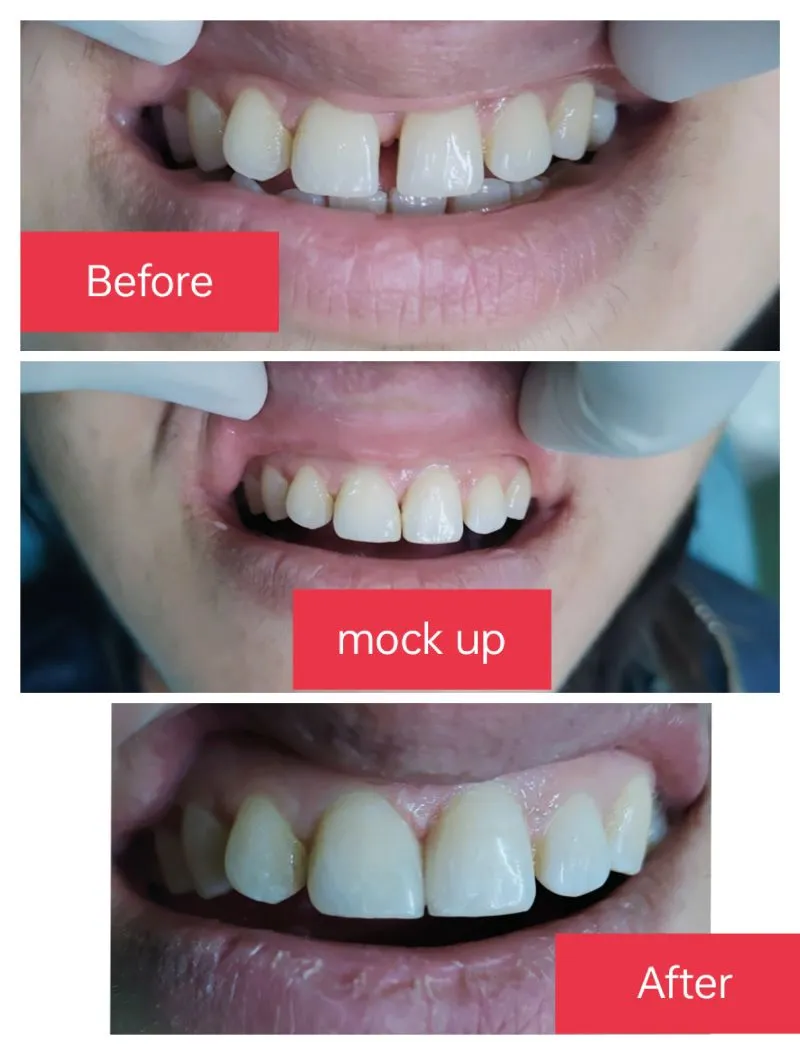 Dental Clinic Near me
If you are looking best den...