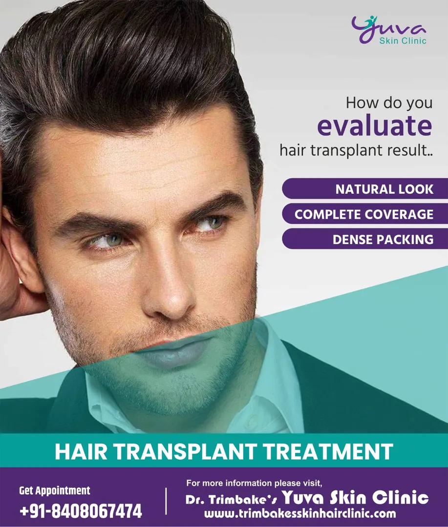 Hair loss can be an unpleasant experience for many...