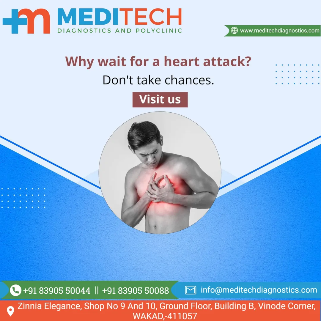 2D echocardiography, popularly called 2D echo, is ...