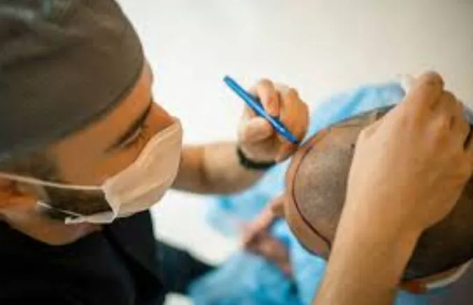 Hair Transplant Services at Gindodia Hospital, Dhu...