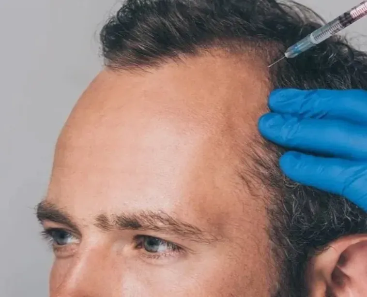 Best PRP Therapy for Hair in Baner Experience the ...