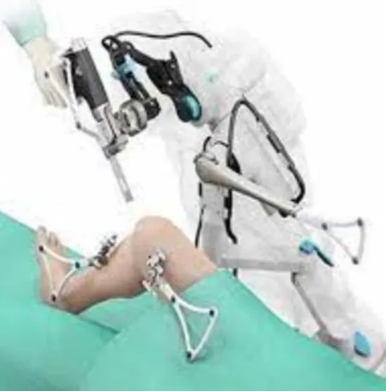 Pune's Finest Robotic Knee Replacement Experience ...