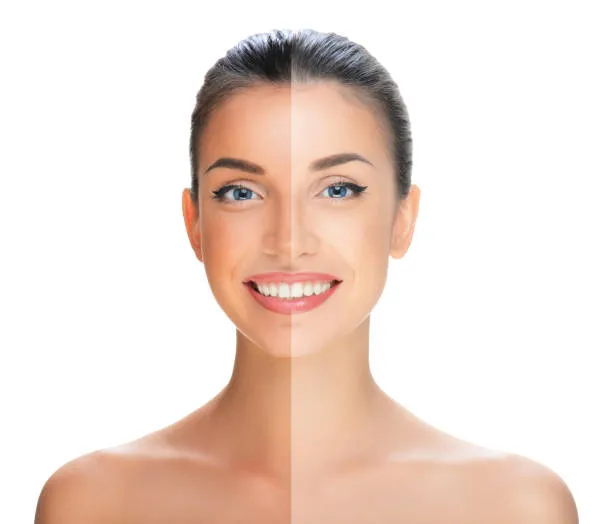Skin Tan Treatment In Nashik Skin Tan Treatment In...