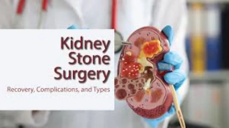 Best Kidney Stone Surgeon in Thane: Expertise You ...