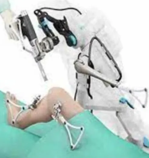 Robot-Assisted Knee Joint Replacement Surgery Revo...