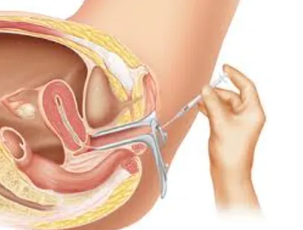 IUI treatment near me Trusted IUI Services at Jija...