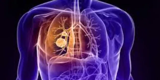 Thoracic Surgery at Dr. K G Deshpande Memorial Cen...