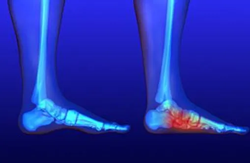Deformity Correction Services by Anand Orthopaedic...