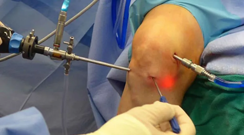 Arthroscopy Services in Nashik State-of-the-Art Ar...