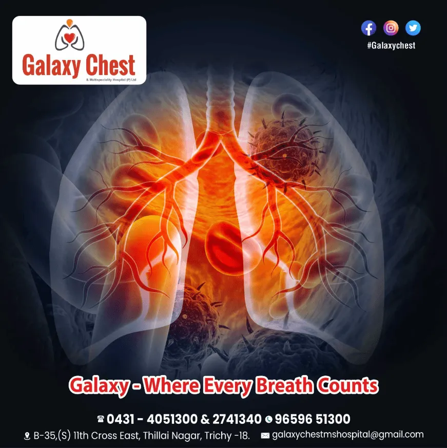 Chest Doctor - Galaxy Chest and Multi Specialty Ho...