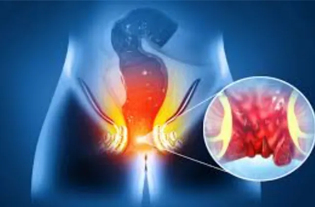 Best Fistula Doctor in Kalyan Premier Fistula Trea...