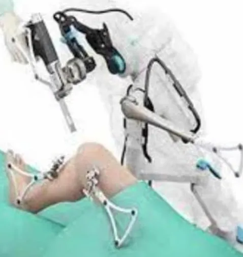 Robot-assisted Knee Joint Replacement Surgery trea...
