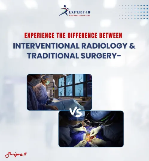 Best Interventional Radiologist in Pune |Best Inte...