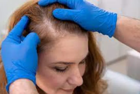 Hair Regrowth Treatment: Your Path to Fuller Hair ...